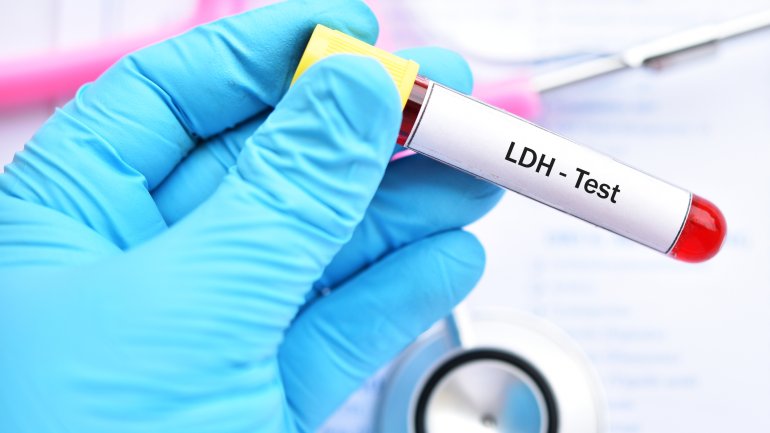 Blutprobe zur Bestimmung des LDH-Wertes